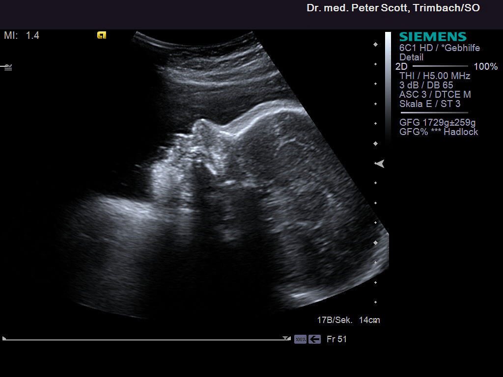  ultraschall